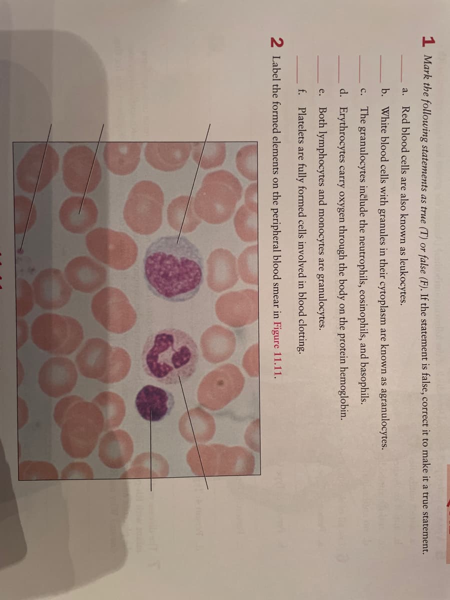 I Mark the following statements as true (T) or false (F), If the statement is false, correct it to make it a true statement.
a. Red blood cells are also known as leukocytes.
b. White blood cells with granules in their cytoplasm are known as agranulocytes.
The granulocytes include the neutrophils, eosinophils, and basophils.
с.
d. Erythrocytes carry oxygen through the body on the protein hemoglobin.
Both lymphocytes and monocytes are granulocytes.
е.
f.
Platelets are fully formed cells involved in blood clotting.
2 Label the formed elements on the peripheral blood smear in Figure 11.11.
