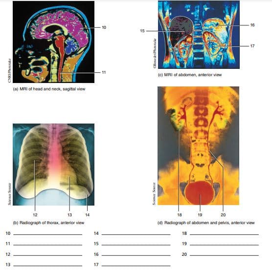 16
15
17
11
(c) MRI of abdomen, anterior view
(a) MRI of head and neck, sagittal view
12
13
14
18
19
20
(b) Radiograph of thorax, anterior view
(d) Radiograph of abdomen and pelvis, anterior view
10
14
18
11
15
19
12
16
20
13
17
CHenedetPhototake
anaog ao s
acunog aoung
