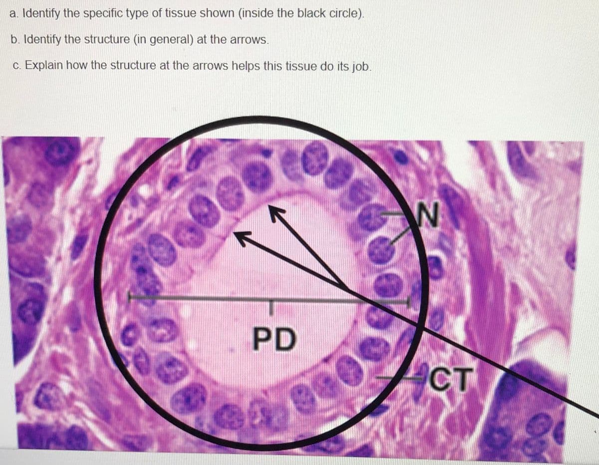 a. Identify the specific type of tissue shown (inside the black circle).
b. Identify the structure (in general) at the arrows.
c. Explain how the structure at the arrows helps this tissue do its job.
PD
CT
