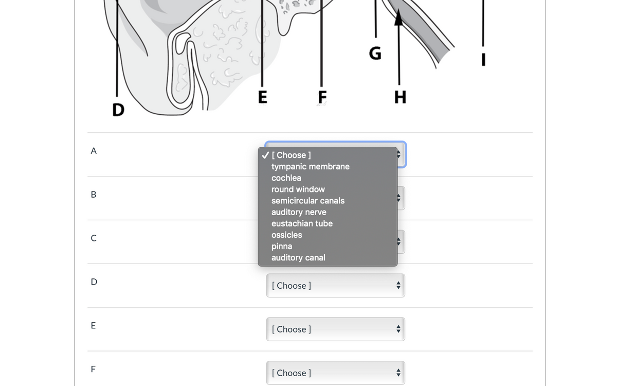 E
F
D
A
V[ Choose ]
tympanic membrane
cochlea
round window
semicircular canals
auditory nerve
eustachian tube
ossicles
pinna
auditory canal
D
[ Choose ]
E
[ Choose ]
F
[ Choose ]
