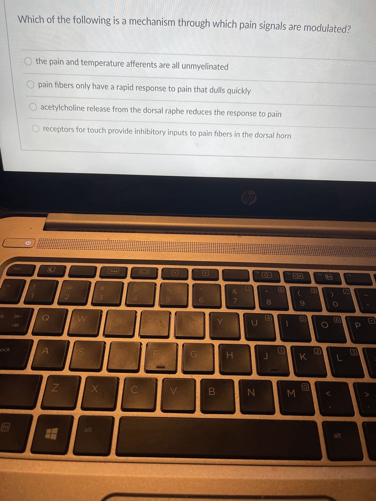 b
ock
Which of the following is a mechanism through which pain signals are modulated?
O the pain and temperature afferents are all unmyelinated
O pain fibers only have a rapid response to pain that dulls quickly
O acetylcholine release from the dorsal raphe reduces the response to pain
O receptors for touch provide inhibitory inputs to pain fibers in the dorsal horn
hp
15
V
esc
C
→
1
Z
a
NO
2
W
S
X
alt
#3
$
69 7
%
5
V
6
B
f7
&
H
7
fg
N
8
4
J
00
fg
M
5
K
9
f10
2
6
L
alt
M11
3
