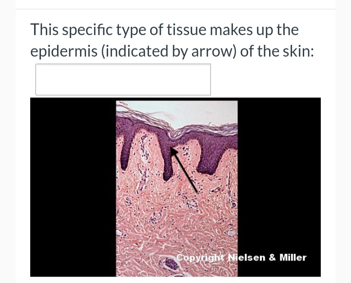 This specific type of tissue makes up the
epidermis (indicated by arrow) of the skin:
Copyright Nielsen & Miller
