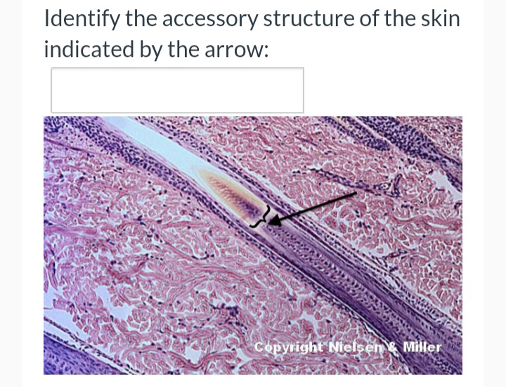 Identify the accessory structure of the skin
indicated by the arrow:
Copyright Nielsen & Miller
