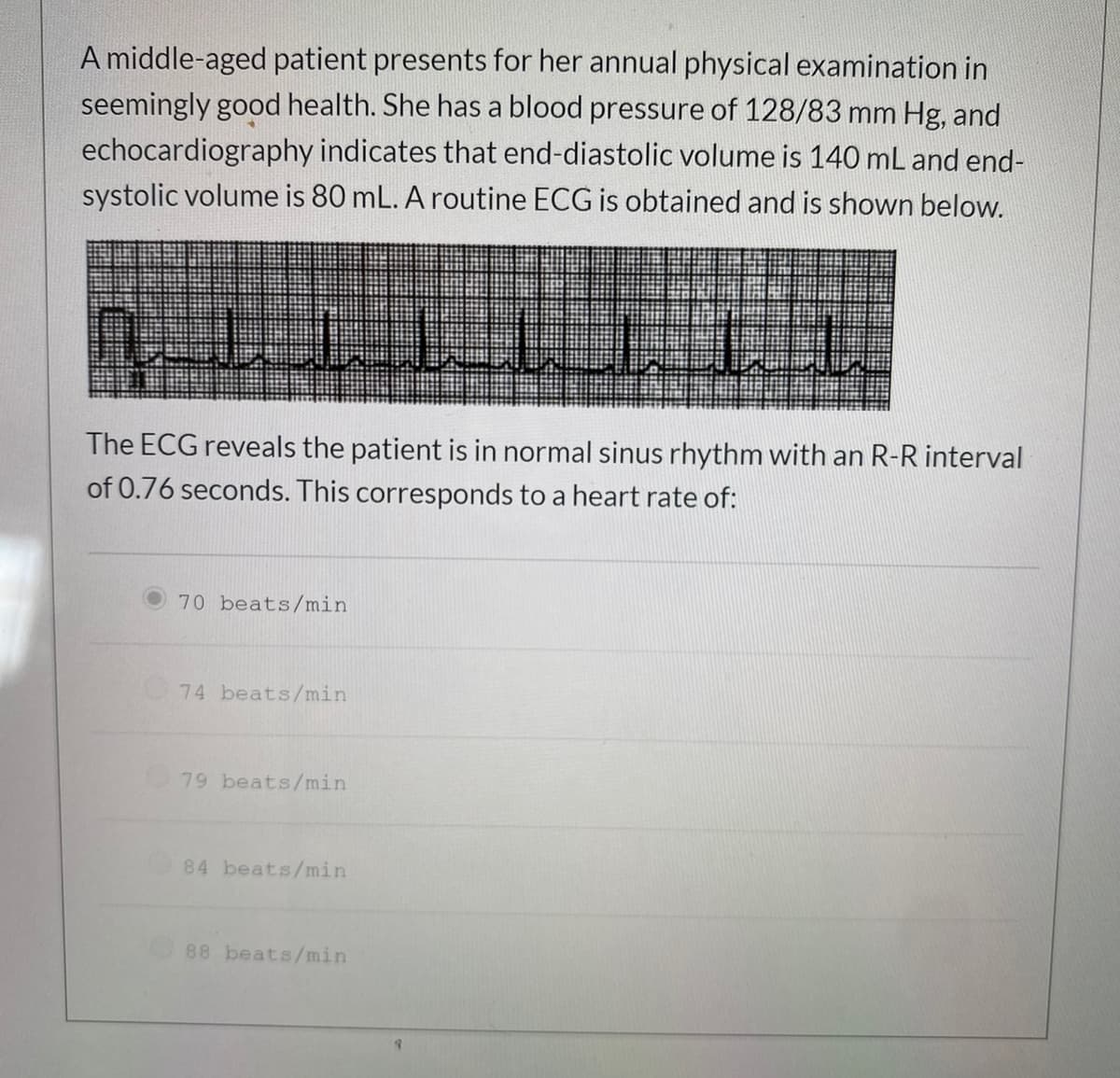 A middle-aged patient presents for her annual physical examination in
seemingly good health. She has a blood pressure of 128/83 mm Hg, and
echocardiography indicates that end-diastolic volume is 140 mL and end-
systolic volume is 80 mL. A routine ECG is obtained and is shown below.
The ECG reveals the patient is in normal sinus rhythm with an R-R interval
of 0.76 seconds. This corresponds to a heart rate of:
70 beats/min
74 beats/min
79 beats/min
84 beats/min
88 beats/min
