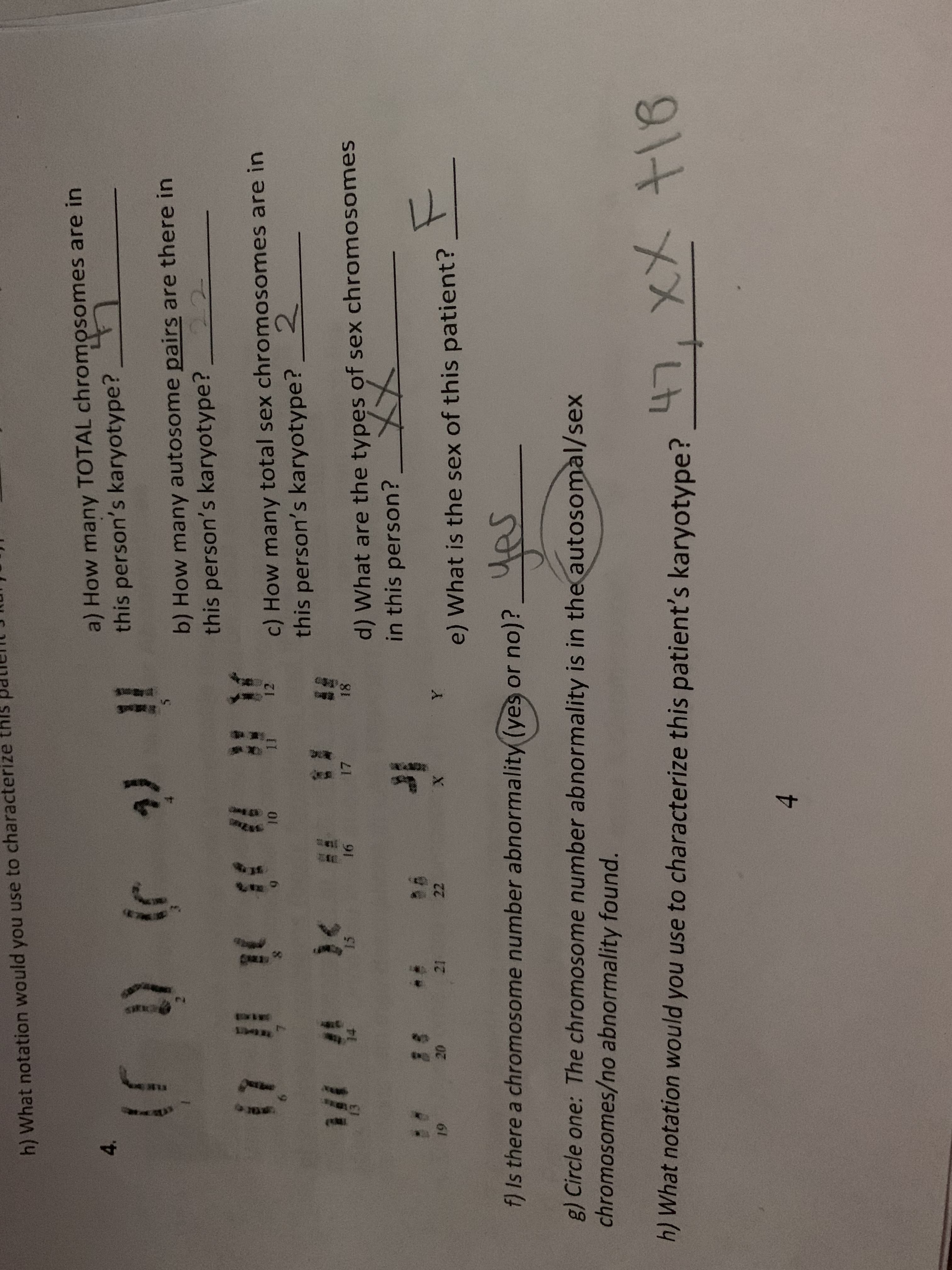 t
SEE
joR
h) What notation would you use to characterize thls
a) How many TOTAL chromosomes are in
this person's karyotype?
it (
t à * # C
b) How many autosome pairs are there in
this person's karyotype?
12
II
c) How many total sex chromosomes are in
this person's karyotype? 2
S
18
15
17
Fl
91
d) What are the types of sex chromosomes
in this person?_ X
@E
12
8
gd
X
e) What is the sex of this patient?
f) Is there a chromosome number abnormality (yes or no)?
g) Circle one: The chromosome number abnormality is in theautosomal/sex
chromosomes/no abnormality found.
ग्की चOu.
h) What notation would you use to characterize this patient's karyotype?
Lh
