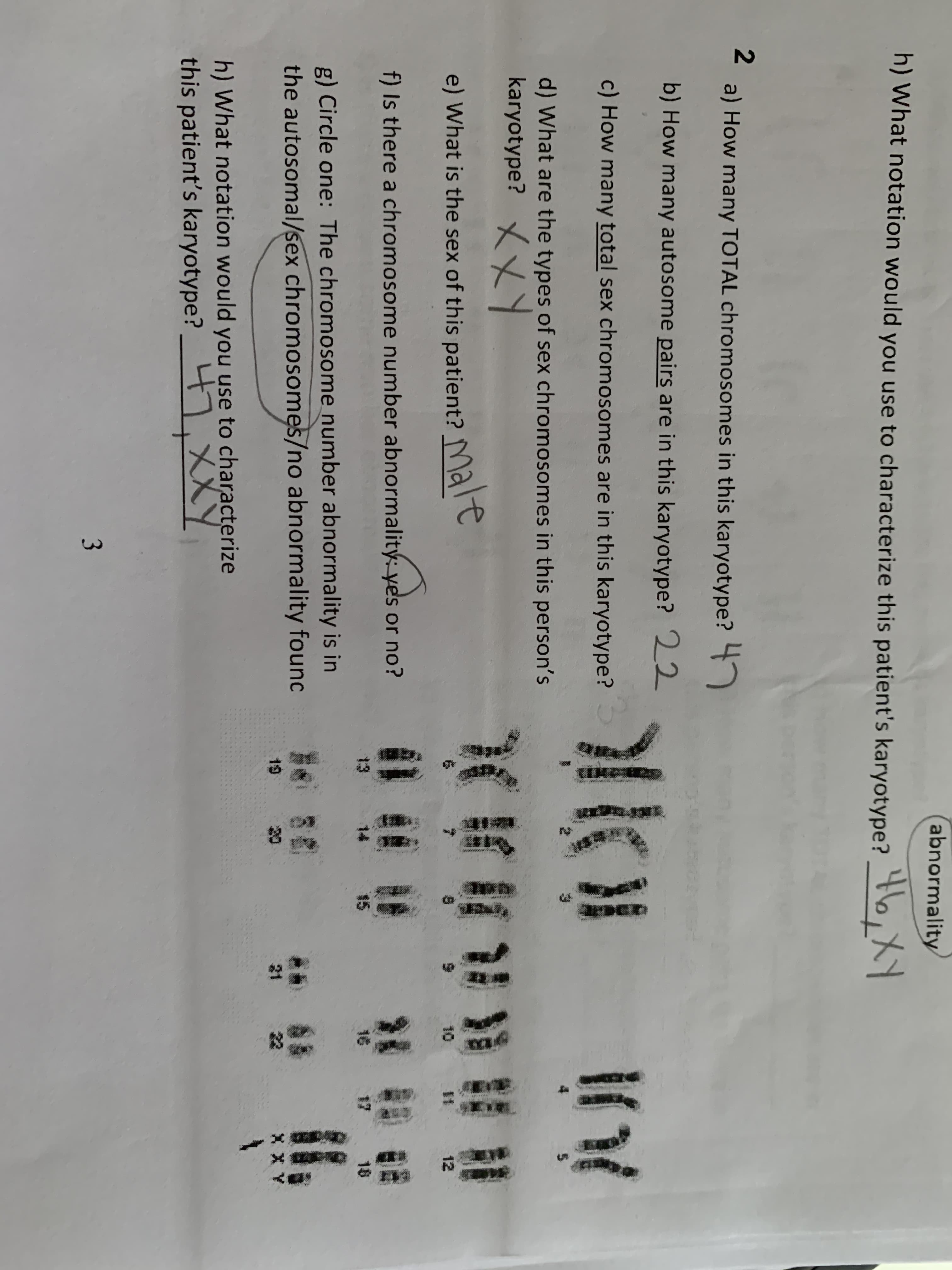 atm>
abnormality
h)What notation would you use to characterize this patient's karyotype?
2
a) How many TOTAL chromosomes in this karyotype?
b) How many autosome pairs are in this karyotype? 22
c) How many total sex chromosomes are in this karyotype?
5
d) What are the types of sex chromosomes in this person's
karyotype?
t
Male
e) What is the sex of this patient?
K t
10
IM
12
f) Is there a chromosome number abnormality: yes or no?
13
14
16
18
g) Circle one: The chromosome number abnormality is in
the autosomal/sex chromosomes/no abnormality founc
as
19
21
h) What notation would you use to characterize
this patient's karyotype? XXY
3
