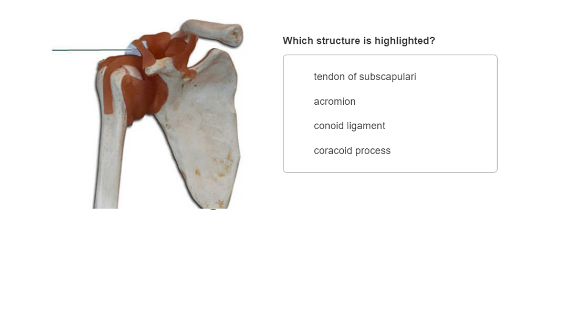 Which structure is highlighted?
tendon of subscapulari
acromion
conoid ligament
coracoid process