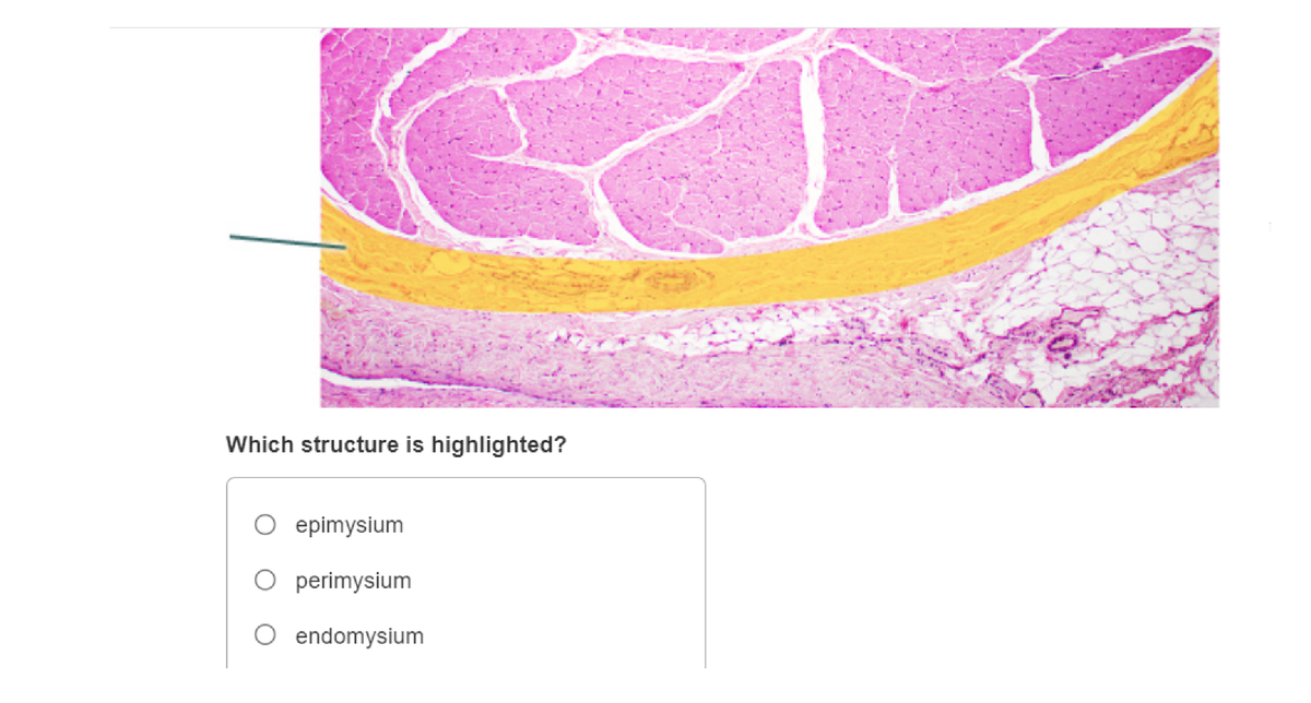 Which structure is highlighted?
epimysium
perimysium
endomysium
T