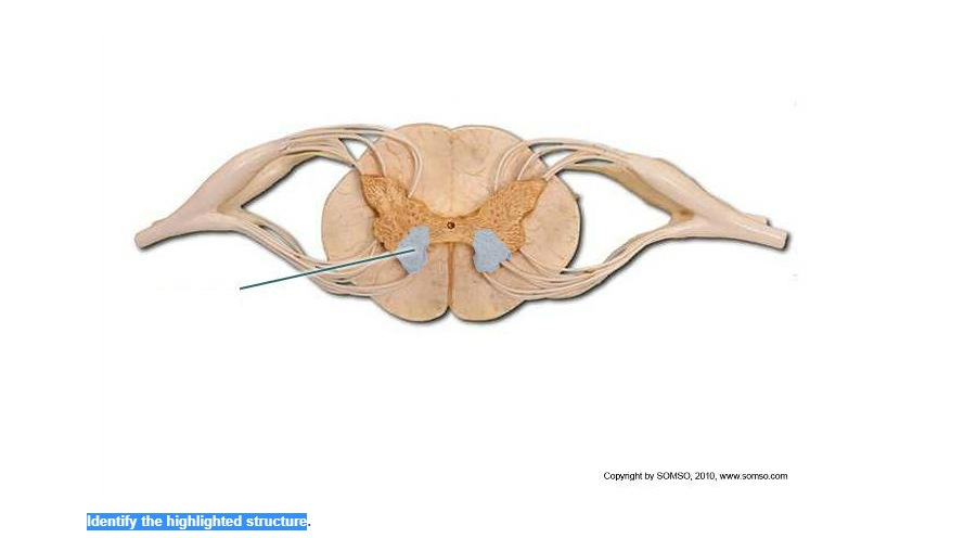 Copyright by SOMSO, 2010, www.somso.com
Identify the highlighted structure.
