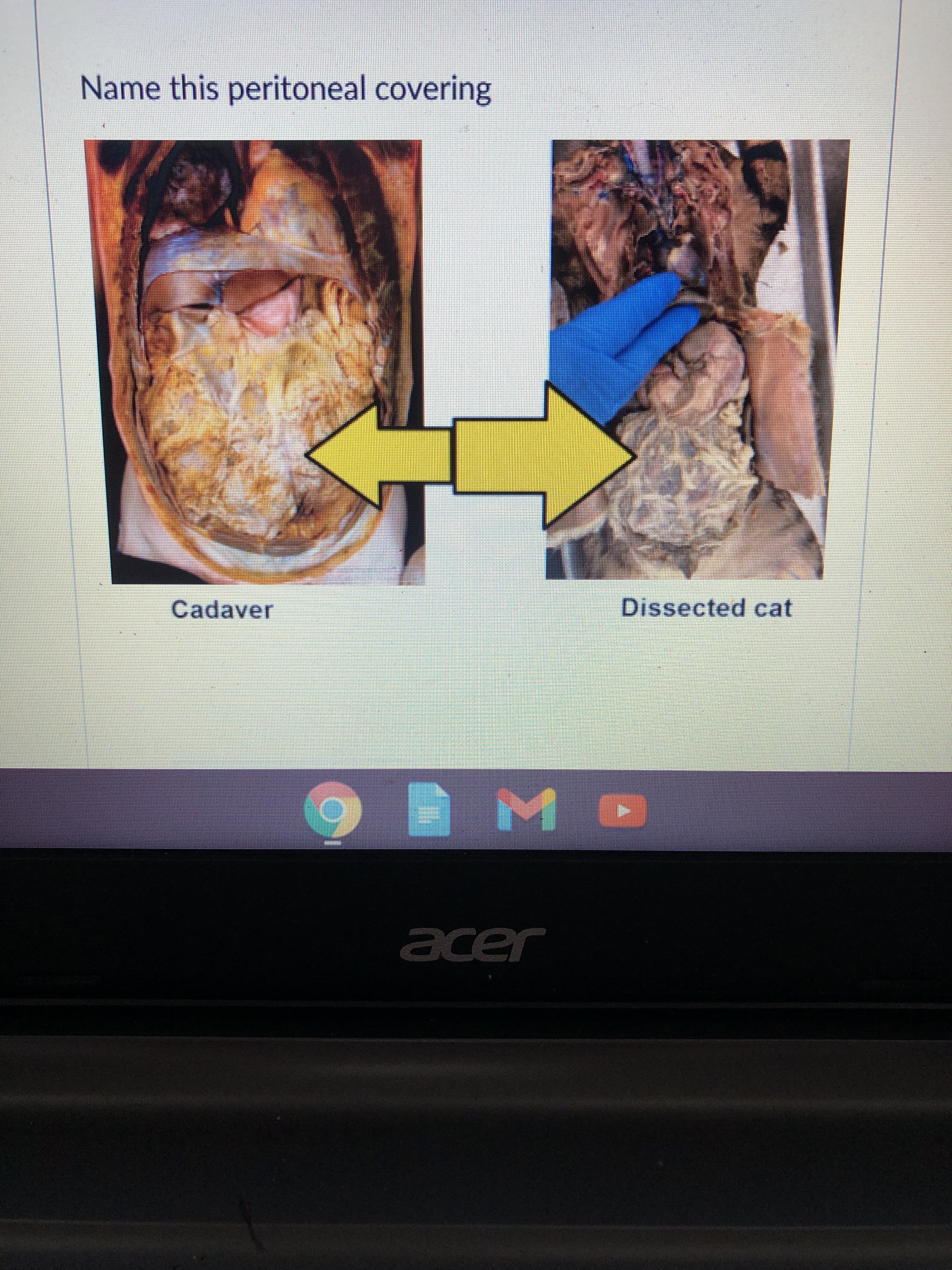 Name this peritoneal covering
Cadaver
Dissected cat
