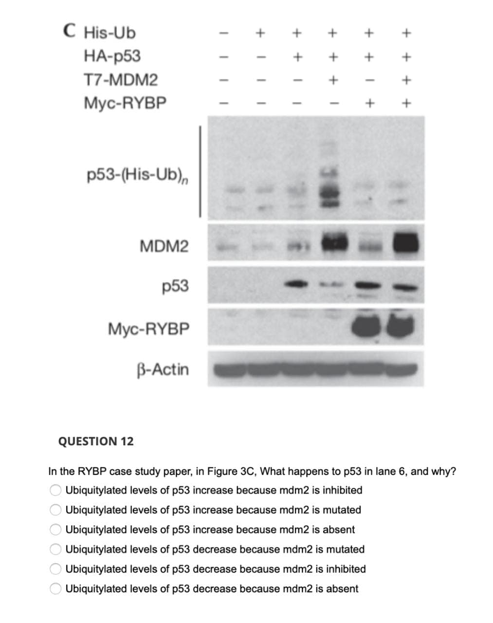 C His-Ub
НА-р53
T7-MDM2
Myc-RYBP
p53-(His-Ub),
MDM2
р53
Myc-RYBP
B-Actin
QUESTION 12
In the RYBP case study paper, in Figure 3C, What happens to p53 in lane 6, and why?
Ubiquitylated levels of p53 increase because mdm2 is inhibited
Ubiquitylated levels of p53 increase because mdm2 is mutated
Ubiquitylated levels of p53 increase because mdm2 is absent
Ubiquitylated levels of p53 decrease because mdm2 is mutated
Ubiquitylated levels of p53 decrease because mdm2 is inhibited
Ubiquitylated levels of p53 decrease because mdm2 is absent
+
+ + +
+
EO O OO OO
