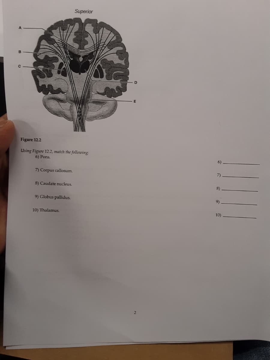 Superior
Figure 12.2
Using Figure 12.2, match the following:
6) Pons,
6)
7) Corpus callosum.
7)
8) Caudate nucleus.
8)
9) Globus pallidus.
9)
10) Thalamus.
10)
