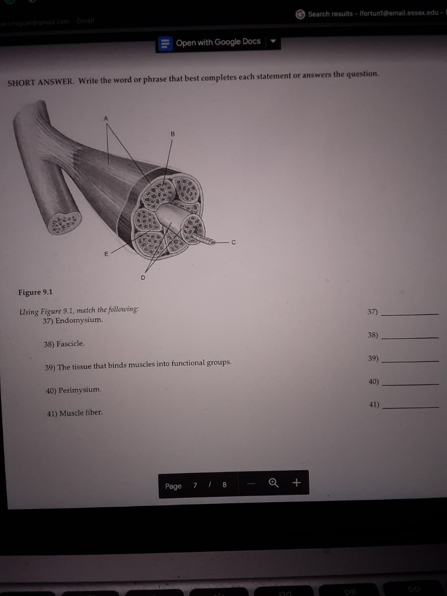 G Search results - Ifortun1@email.essex.edu - E
narcmiguel@gmail.com- Gmail
Open with Google Docs
SHORT ANSWER. Write the word or phrase that best completes each statement or answers the question.
Figure 9.1
Using Figure 9.1, match the following:
37) Endomysium.
37)
38) Fascicle.
38)
39) The tissue that binds muscles into functional groups.
39)
40) Perimysium.
40)
41) Muscle fiber.
41)
Page
7 | 8
