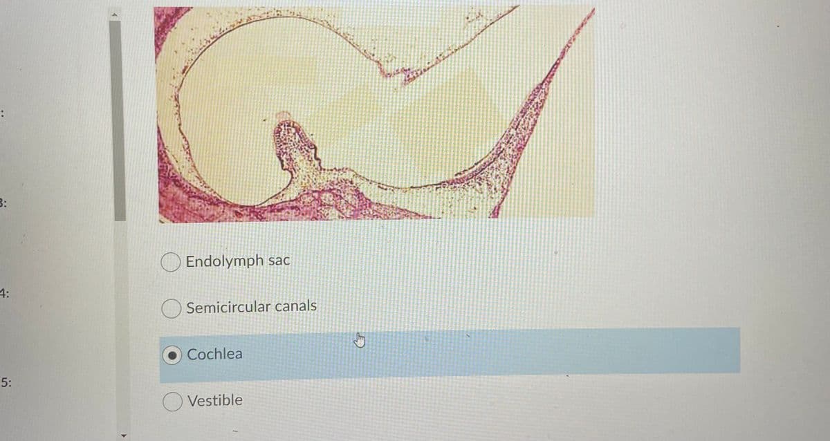 3:
Endolymph sac
4:
O Semicircular canals
Cochlea
O Vestible
5:
