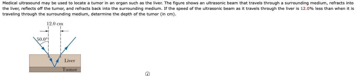 Medical ultrasound may be used to locate
the liver, reflects off the tumor, and refracts back into the surrounding medium. If the speed of the ultrasonic beam as it travels through the liver is 12.0% less than when it is
traveling through the surrounding medium, determine the depth of the tumor (in cm).
tumor in an organ such as the liver. The figure shows an ultrasonic beam that travels through a surrounding medium, refracts into
12.0 cm
50.0°!
Liver
Tumor
