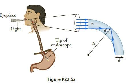 Eyepiece
Light
Tip of
endoscope
R
d.
Figure P22.52
