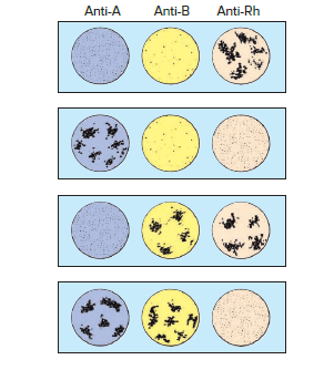 Anti-A
Anti-B
Anti-Rh
