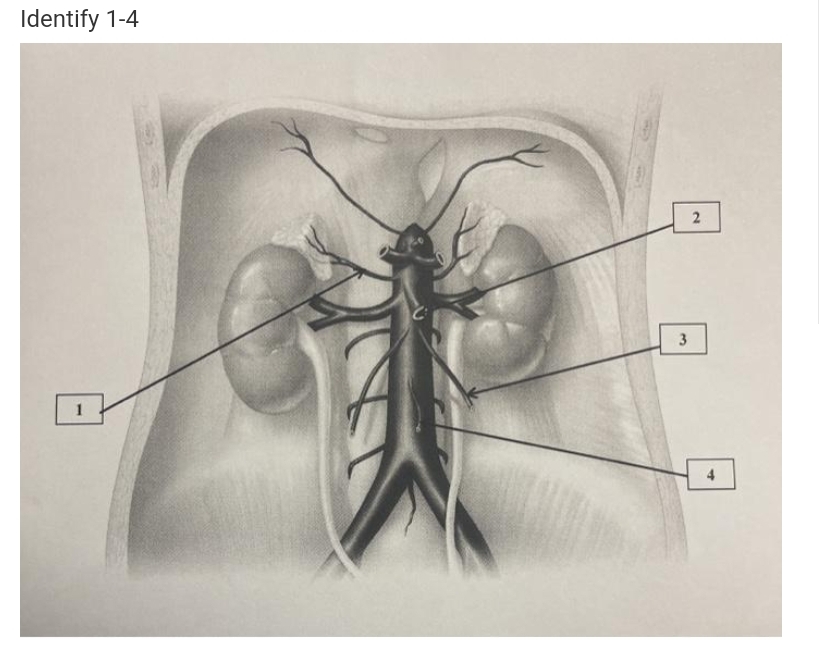 Identify 1-4
2
3
4
