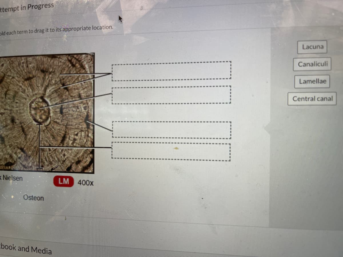ttempt in Progress
old each term to drag it to its appropriate location.
Nielsen
Osteon
book and Media
LM 400x
Lacuna
Canaliculi
Lamellae
Central canal