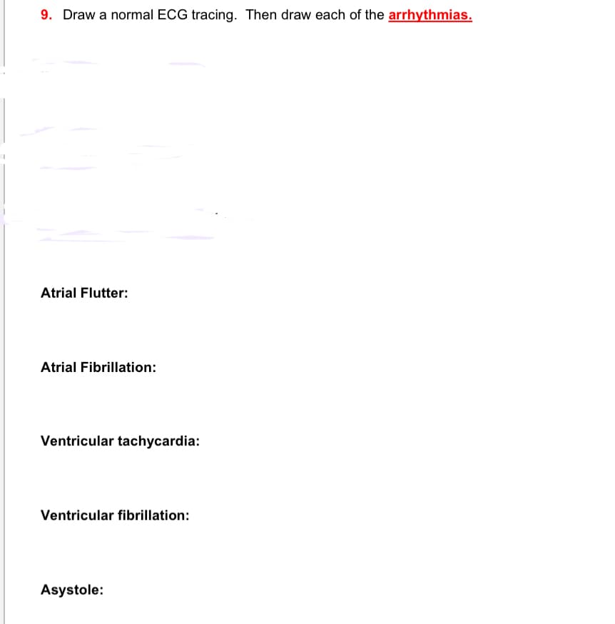 9. Draw a normal ECG tracing. Then draw each of the arrhythmias.
Atrial Flutter:
Atrial Fibrillation:
Ventricular tachycardia:
Ventricular fibrillation:
Asystole:
