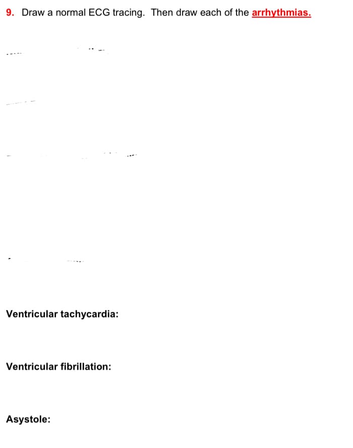 9. Draw a normal ECG tracing. Then draw each of the arrhythmias.
Ventricular tachycardia:
Ventricular fibrillation:
Asystole:
