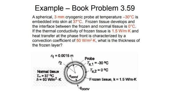 Example – Book Problem 3.59
A spherical, 3 mm cryogenic probe at temperature -30 C is
embedded into skin at 37°C. Frozen tissue develops and
the interface between the frozen and normal tissue is 0°C.
If the thermal conductivity of frozen tissue is 1.5 W/m-K and
heat transfer at the phase front is characterized by a
convection coefficient of 50 W/m?-K, what is the thickness of
the frozen layer?
4= 0.0015 m
Probe
T8.1 30 °C
-T22=0°C
12
Normal tissue
Ten = 37 °C
h= 50 Wim2 -K
oond
Frozen tissue, k= 1.5 WimK
doonv
