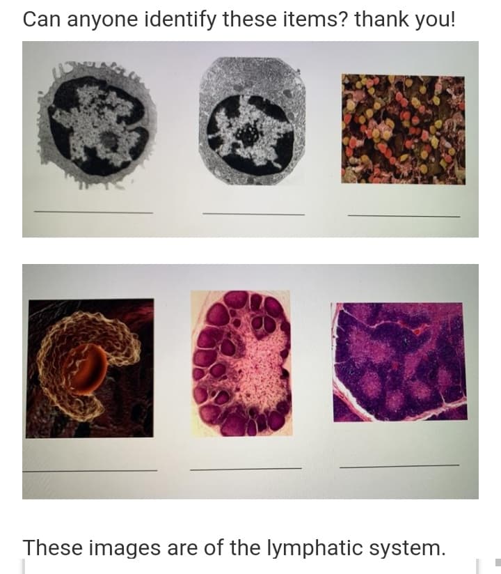 Can anyone identify these items? thank you!
These images are of the lymphatic system.
