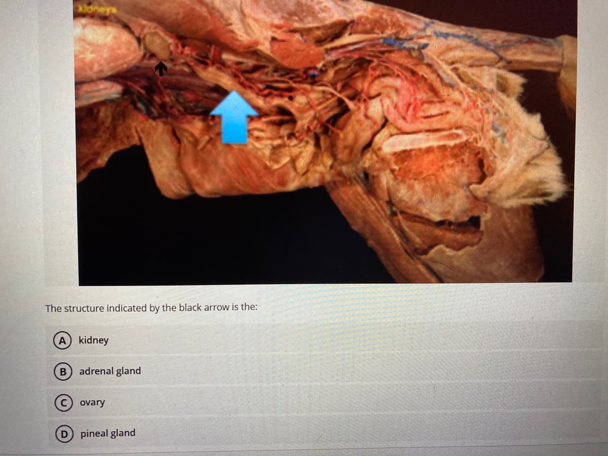 heys
The structure indicated by the black arrow is the:
A kidney
adrenal gland
ovary
D pineal gland
