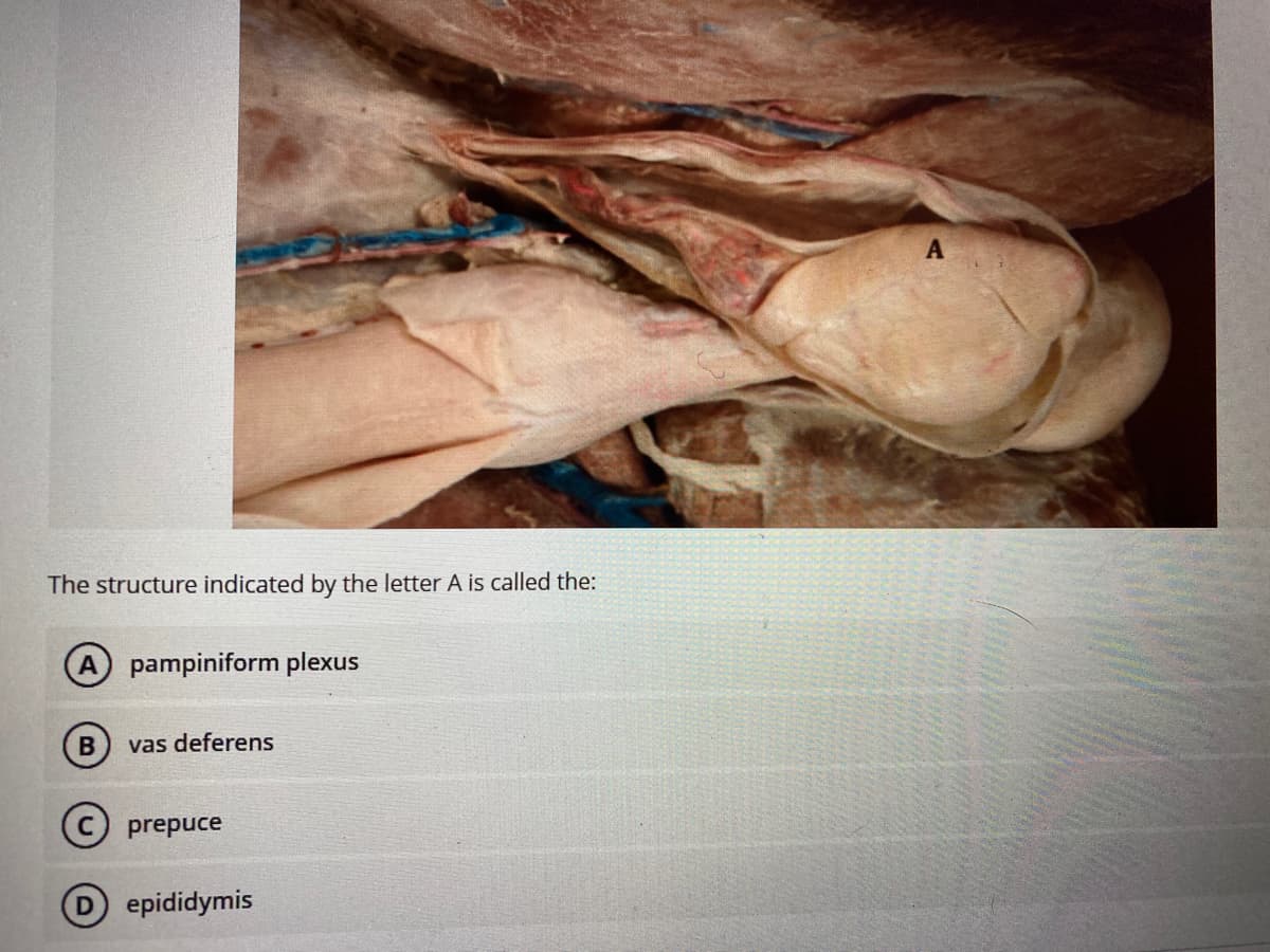 The structure indicated by the letter A is called the:
A pampiniform plexus
vas deferens
prepuce
epididymis
