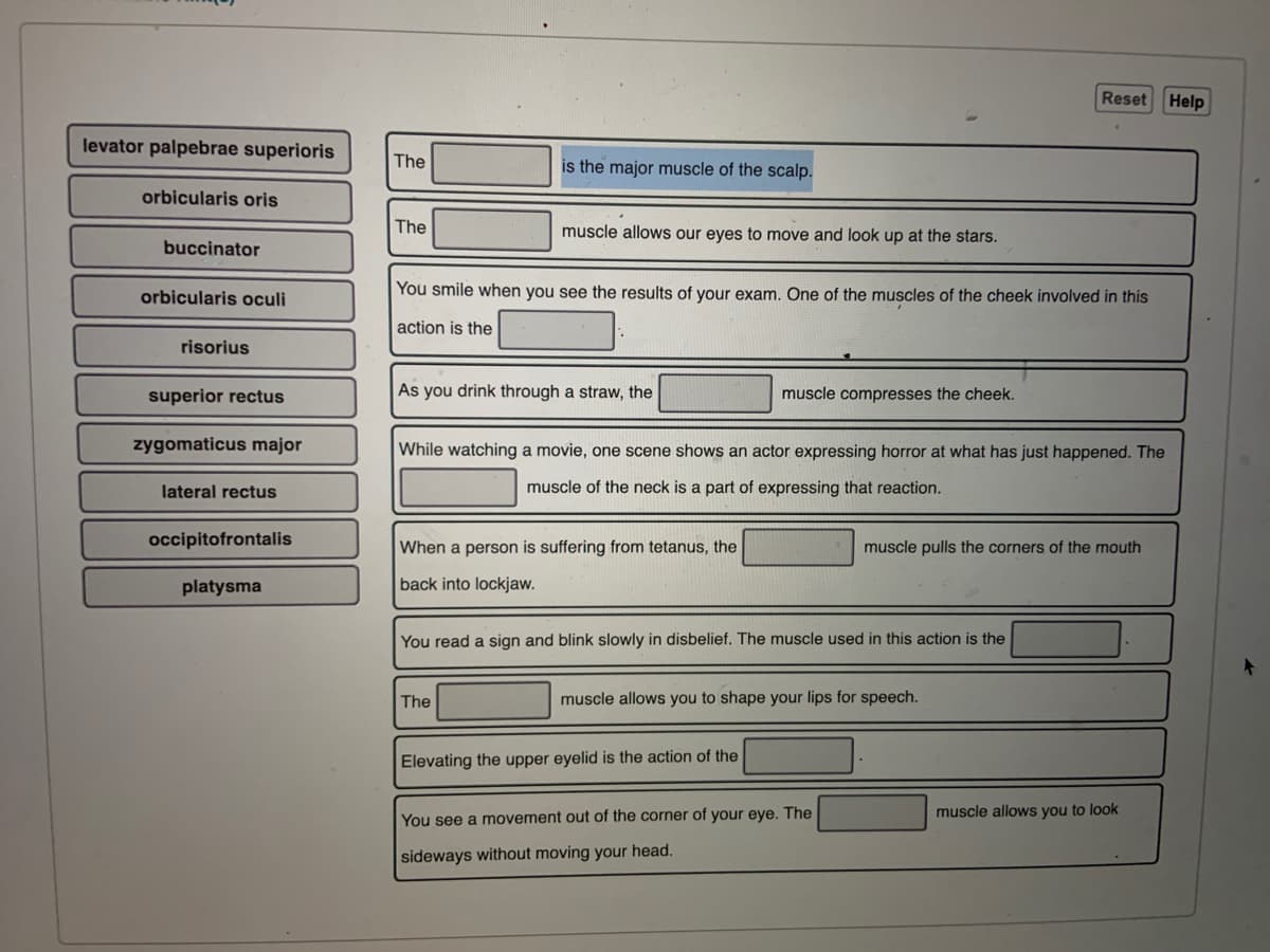 Reset Help
levator palpebrae superioris
The
is the major muscle of the scalp.
orbicularis oris
The
muscle allows our eyes to move and look up at the stars.
buccinator
orbicularis oculi
You smile when you see the results of your exam. One of the muscles of the cheek involved in this
action is the
risorius
superior rectus
As you drink through a straw, the
muscle compresses the cheek.
zygomaticus major
While watching a movie, one scene shows an actor expressing horror at what has just happened. The
lateral rectus
muscle of the neck is a part of expressing that reaction.
occipitofrontalis
When a person is suffering from tetanus, the
muscle pulls the corners of the mouth
platysma
back into lockjaw.
You read a sign and blink slowly in disbelief. The muscle used in this action is the
The
muscle allows you to shape your lips for speech.
Elevating the upper eyelid is the action of the
You see a movement out of the corner of your eye. The
muscle allows you to look
sideways without moving your head.
