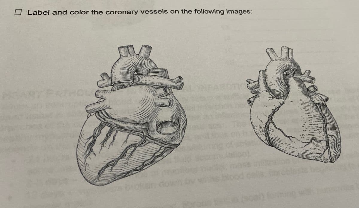 O Label and color the coronary vessels on the following images:
FAROT
ATHOLO
