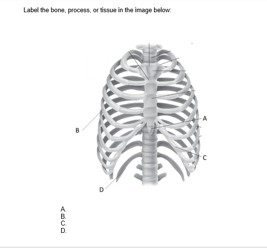 Label the bone, process, or tissue in the image below:
А.
В.
С.
