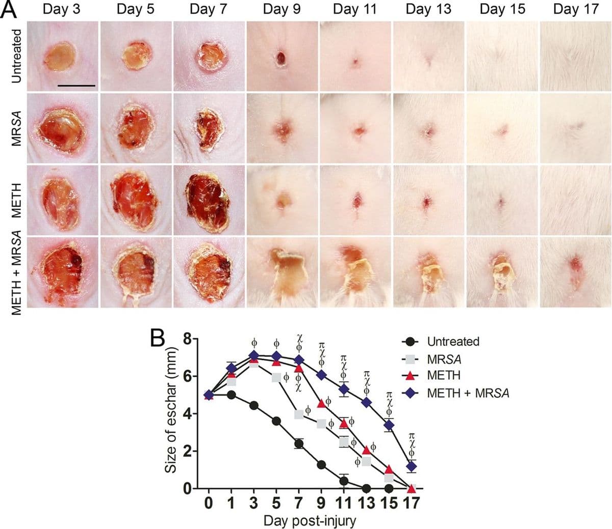 Day 3
Day 5
Day 7
Day 9
Day 11
Day 13
Day 15
Day 17
B 8-
Untreated
MRSA
МЕТH
METH + MRSA
0 1 3 5 7 9 11 13 15 17
Day post-injury
METH + MRSA METH
MRSA
Untreated
Size of eschar (mm)
2-
