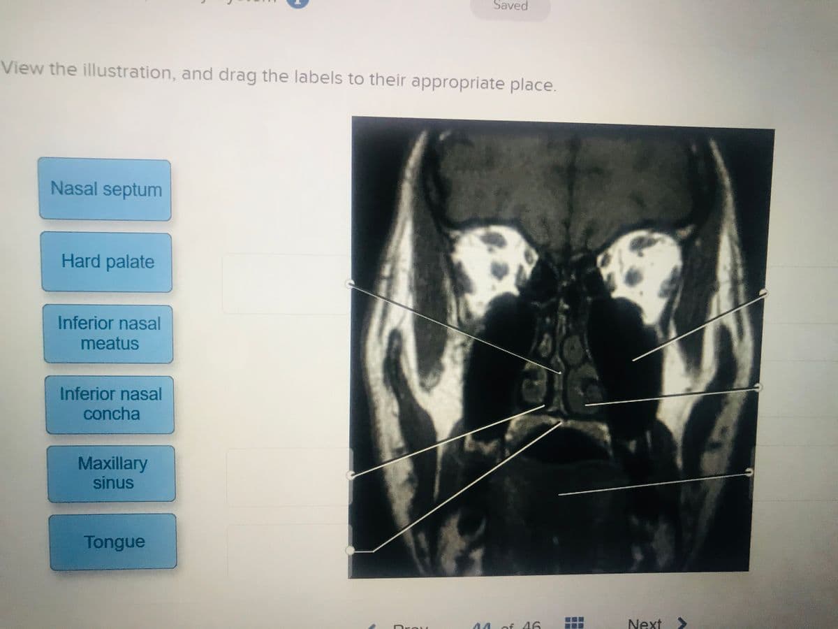 Saved
View the illustration, and drag the labels to their appropriate place.
Nasal septum
Hard palate
Inferior nasal
meatus
Inferior nasal
concha
Maxillary
sinus
Tongue
04 of 46
Next >
