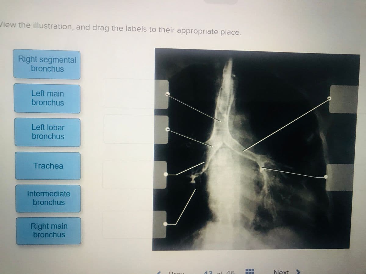 View the illustration, and drag the labels to their appropriate place.
Right segmental
bronchus
Left main
bronchus
Left lobar
bronchus
Trachea
Intermediate
bronchus
Right main
bronchus
Drov
43 of 46
Next
