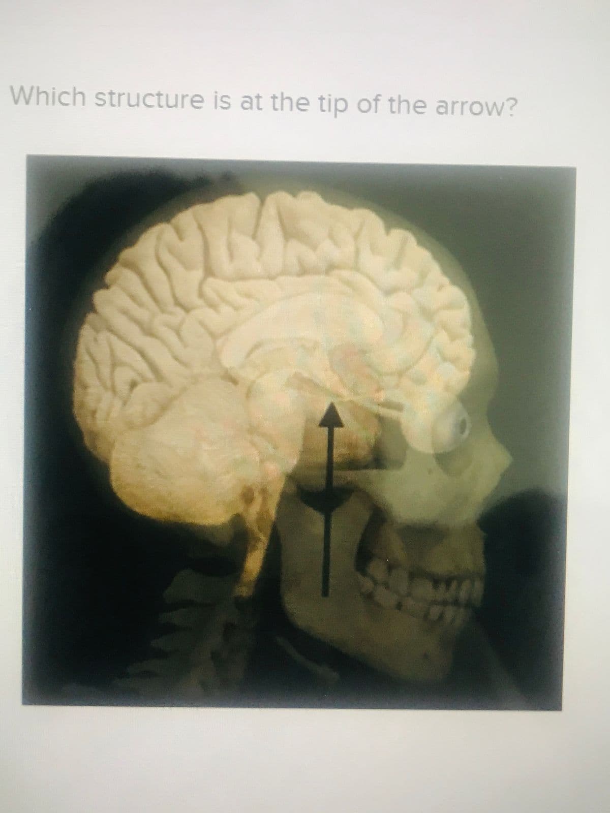 Which structure is at the tip of the arrow?
