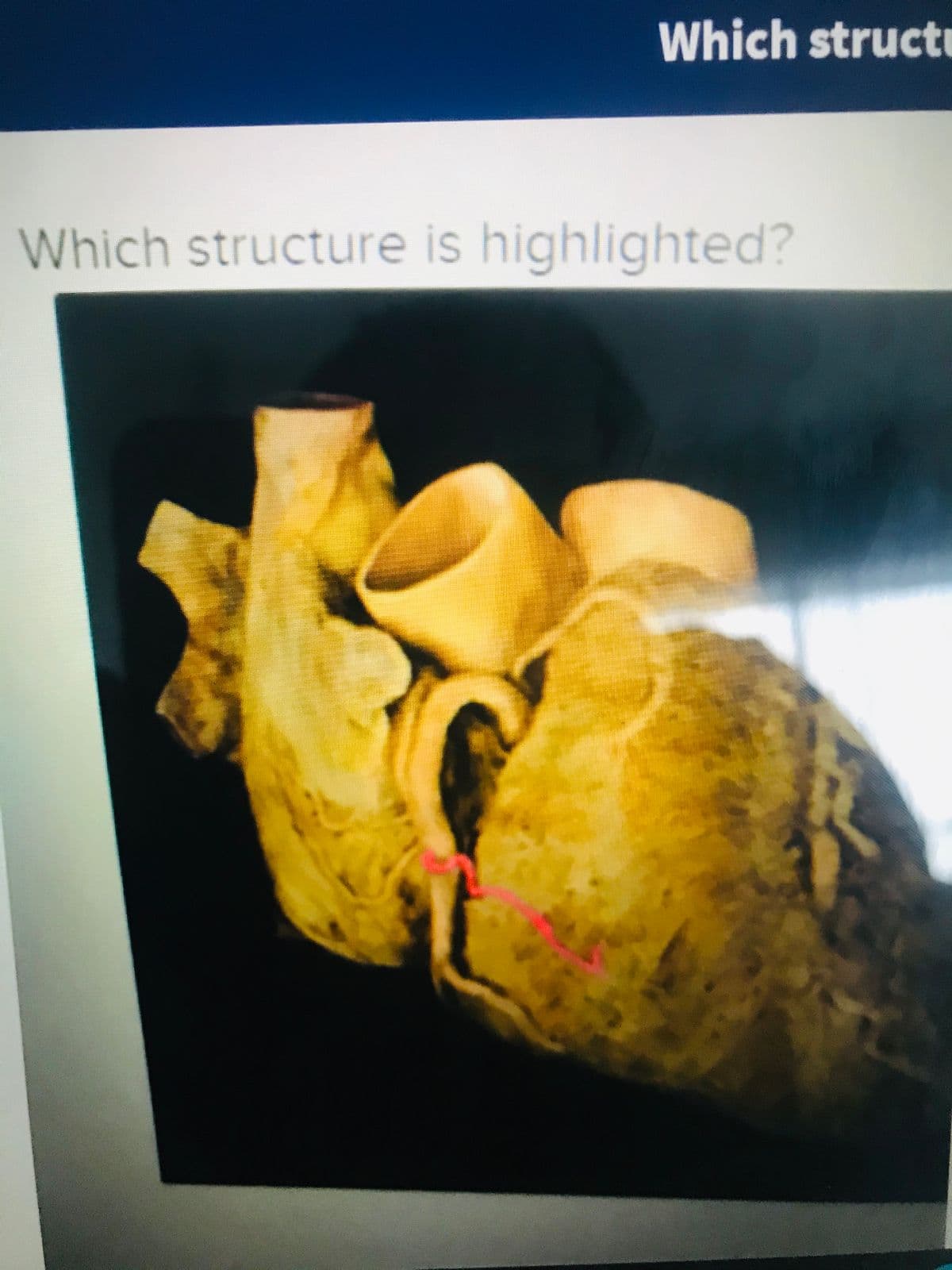 Which structı
Which structure is highlighted?
