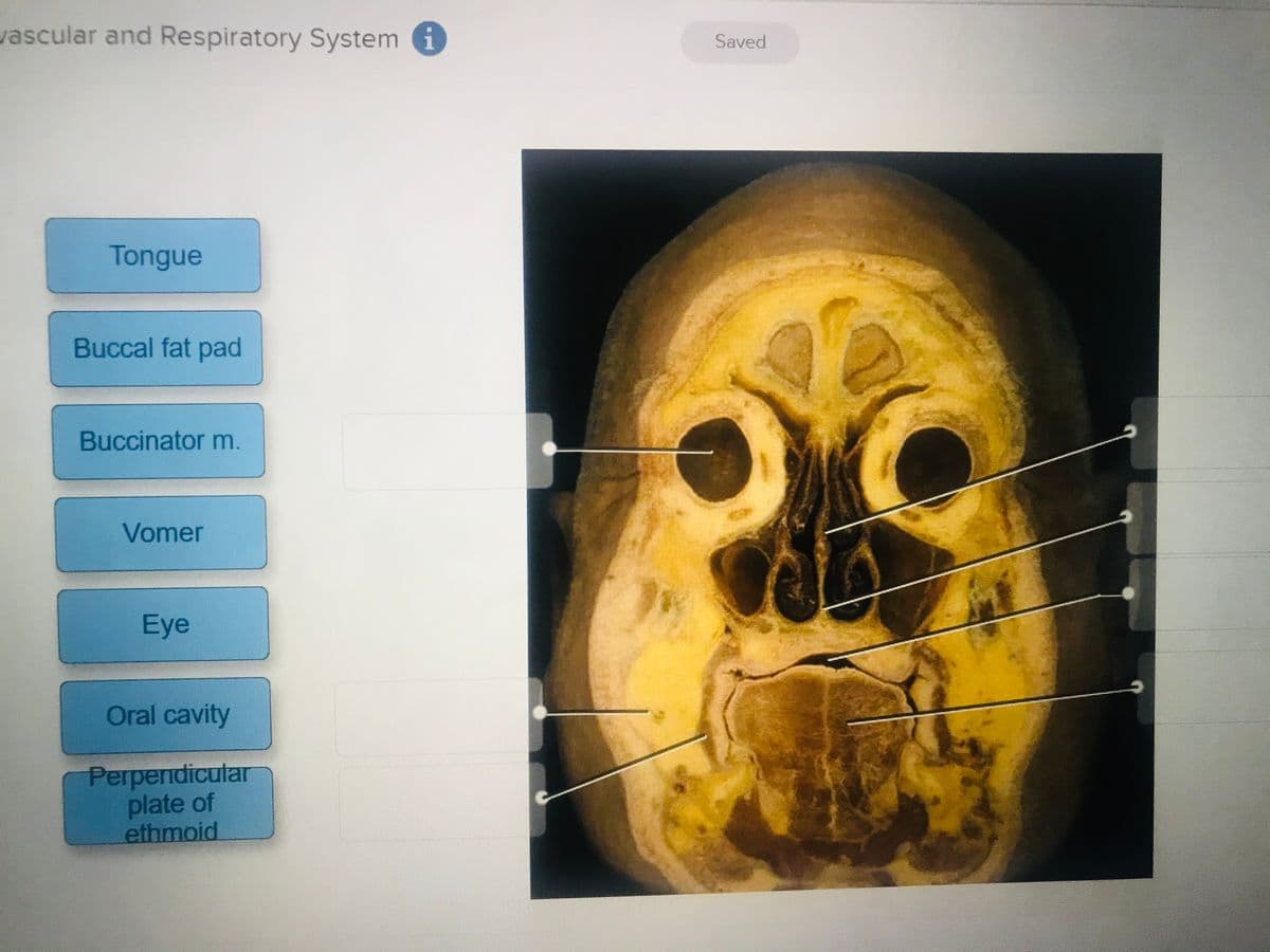 vascular and Respiratory System i
Saved
Tongue
Buccal fat pad
Buccinator m.
Vomer
Eye
Oral cavity
Perpendicular
plate of
ethmoid
