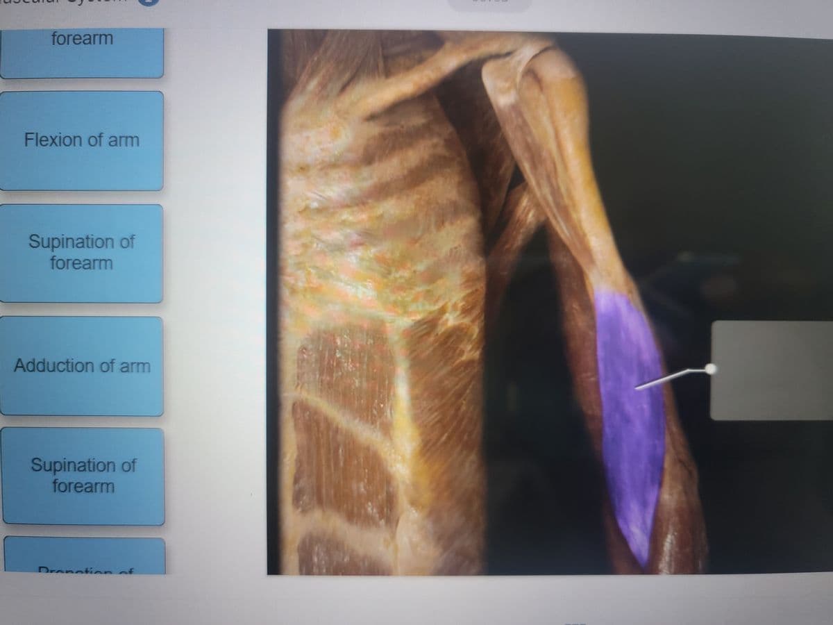 forearm
Flexion of arm
Supination of
forearm
Adduction of arm
Supination of
forearm
Dronetionof
