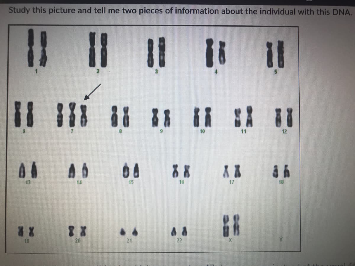 Study this picture and tell me two pieces of information about the individual with this DNA.
%3D
%3D
10
11
12
13
14
15
16
17
18
19
20
21
22
