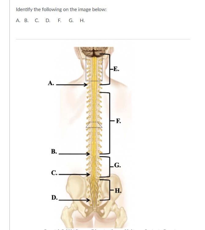 Identify the following on the image below:
A. B. C. D. F. G. H.
A.
B.
C..
D.
STUP
E.
F.
LG.
H.